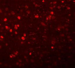 Immunocytochemistry/Immunofluorescence: Synaptogyrin 1 Antibody [NBP1-77371] - Immunofluorescence of SYNGR1 in rat brain tissue with SYNGR1 antibody at 20 ug/mL.