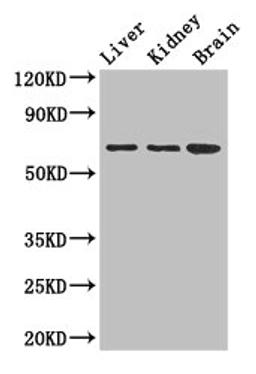 Western Blot. Positive WB detected in: Mouse liver tissue, Mouse kidney tissue, Mouse brain tissue. All lanes: AK5 antibody at 2.5ug/ml. Secondary. Goat polyclonal to rabbit IgG at 1/50000 dilution. Predicted band size: 64, 22, 61 kDa. Observed band size: 64 kDa. 