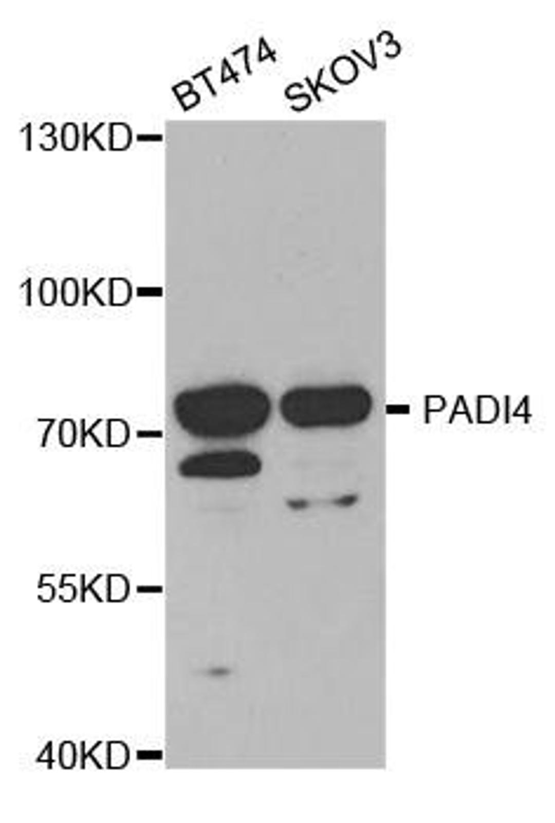 Western blot analysis of extracts of various cell lines using PADI4 antibody