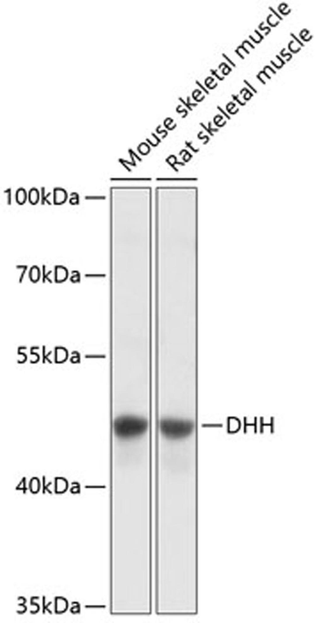 Western blot - DHH antibody (A13177)