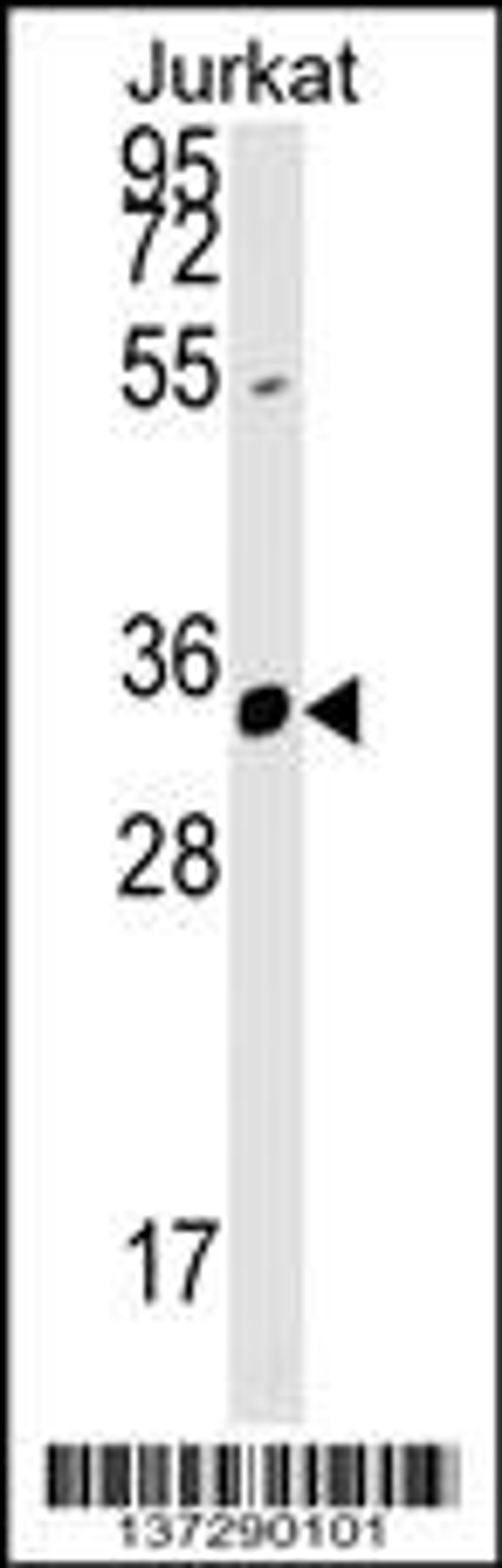 Western blot analysis in Jurkat cell line lysates (35ug/lane).