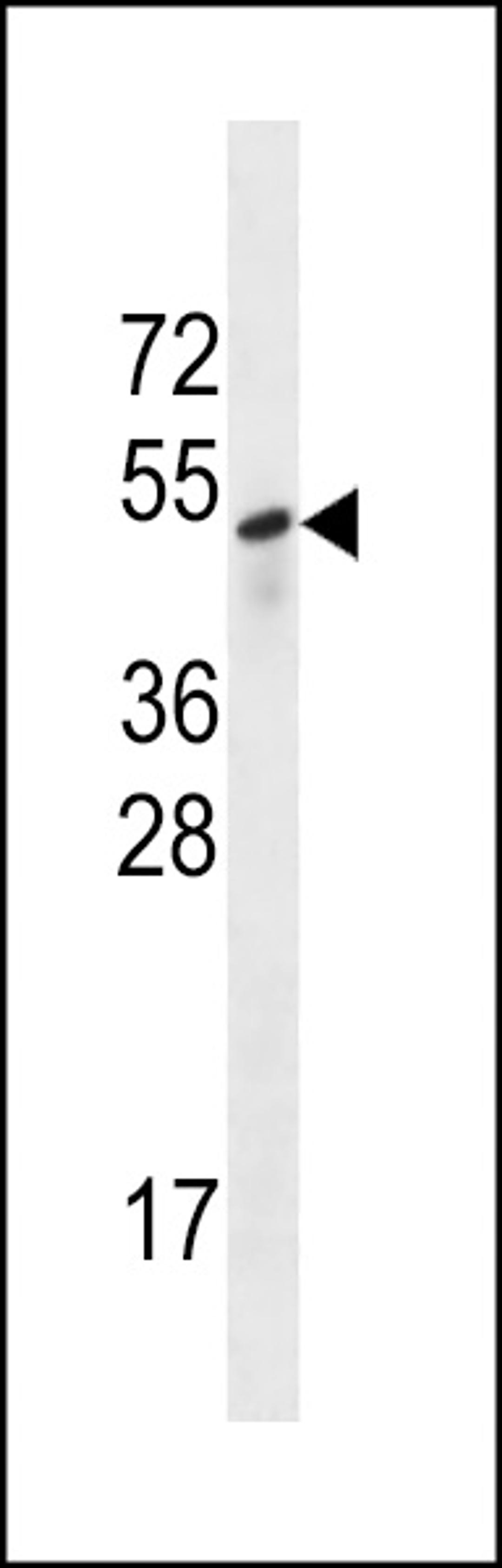 Western blot analysis in A549 cell line lysates (35ug/lane).This demonstrates the Sestrin-3 antibody detected the Sestrin-3 protein (arrow).