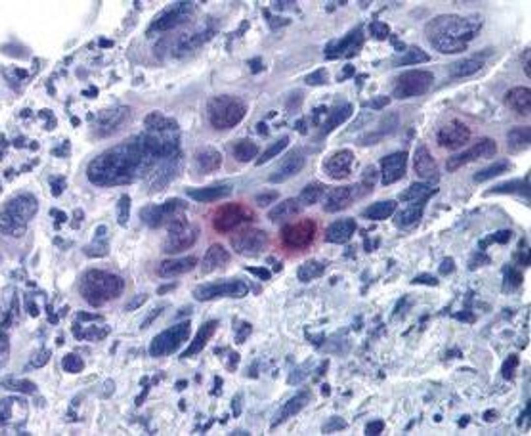 Immunohistochemical staining of human, multi-brain and multi-cancer slides using Mlf1 (phospho-T78) antibody