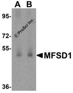 Western blot analysis of MFSD1 in human testis tissue lysate with MFSD1 antibody at (A) 1 and (B) 2 &#956;g/mL.