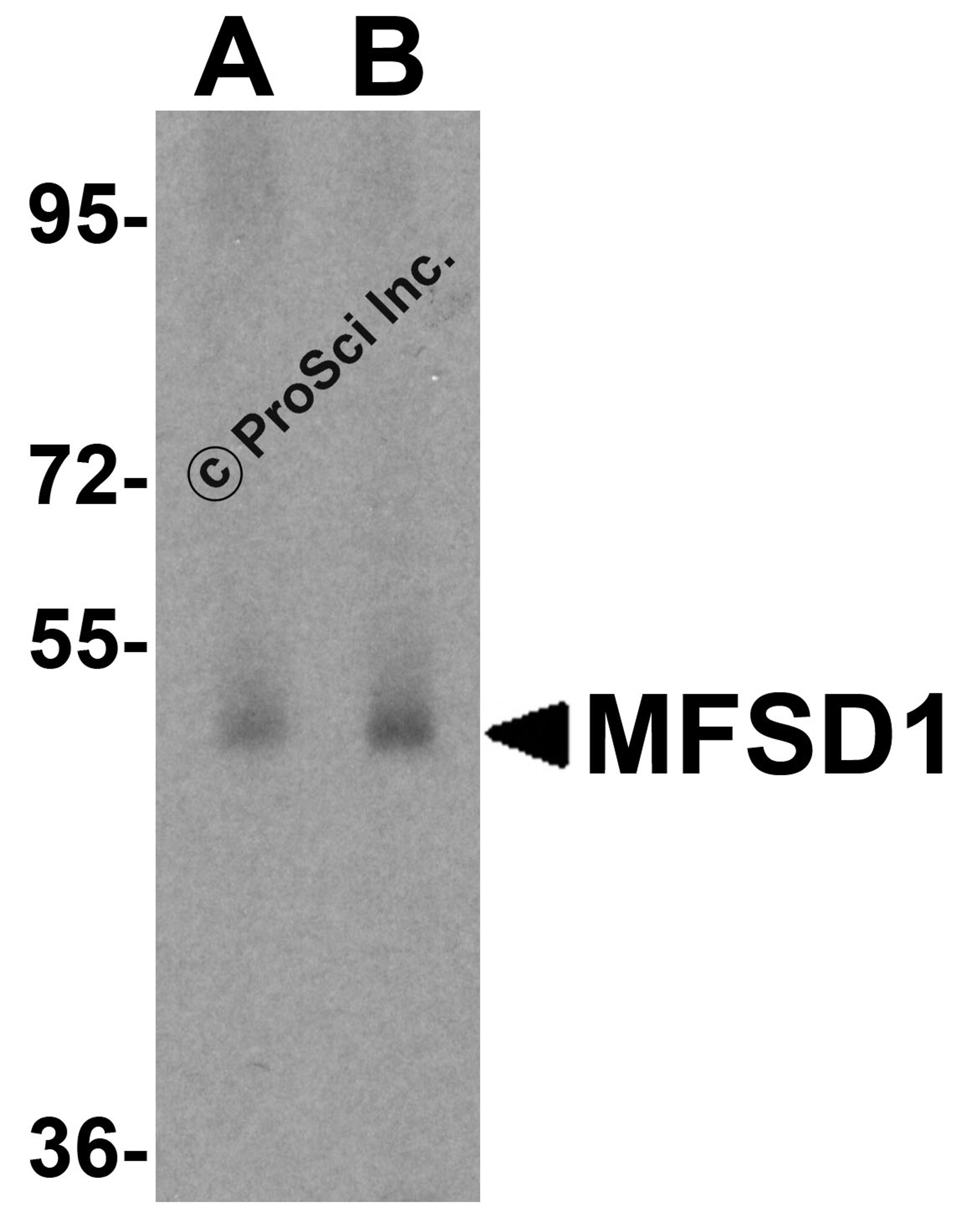 Western blot analysis of MFSD1 in human testis tissue lysate with MFSD1 antibody at (A) 1 and (B) 2 μg/mL.