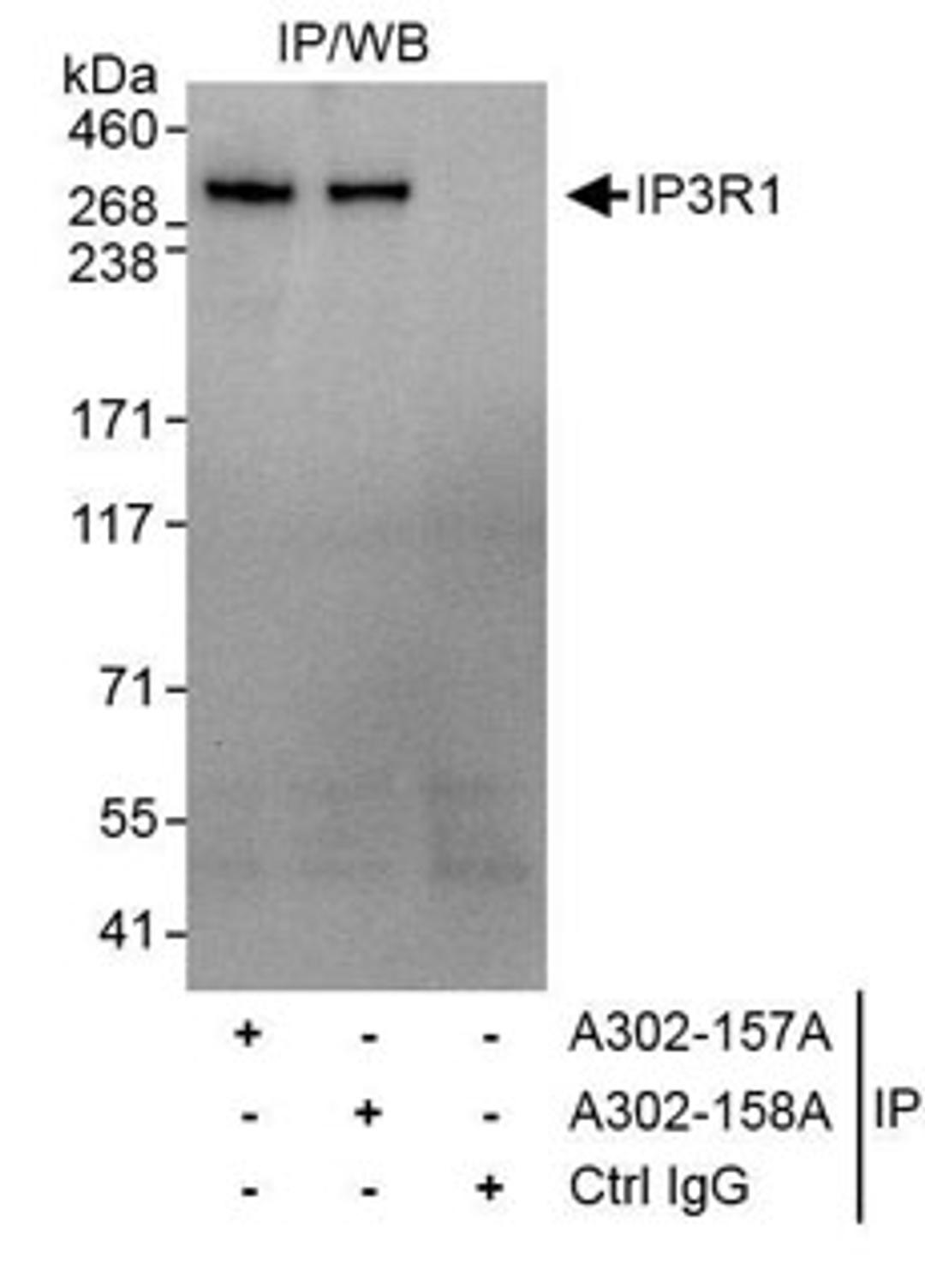 Detection of human IP3R1 by western blot of immunoprecipitates.