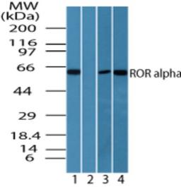 Western Blot: ROR alpha Antibody [NBP2-24519] - Analysis of ROR alpha in human skeletal muscle lysate in the 1) absence and 2) presence of immunizing peptide, 3) mouse skeletal muscle lysate and 4) rat skeletal muscle lysate using this antibody at 25 ug/ml, 0.01 ug/ml and 0.01 ug/ml, respectively.