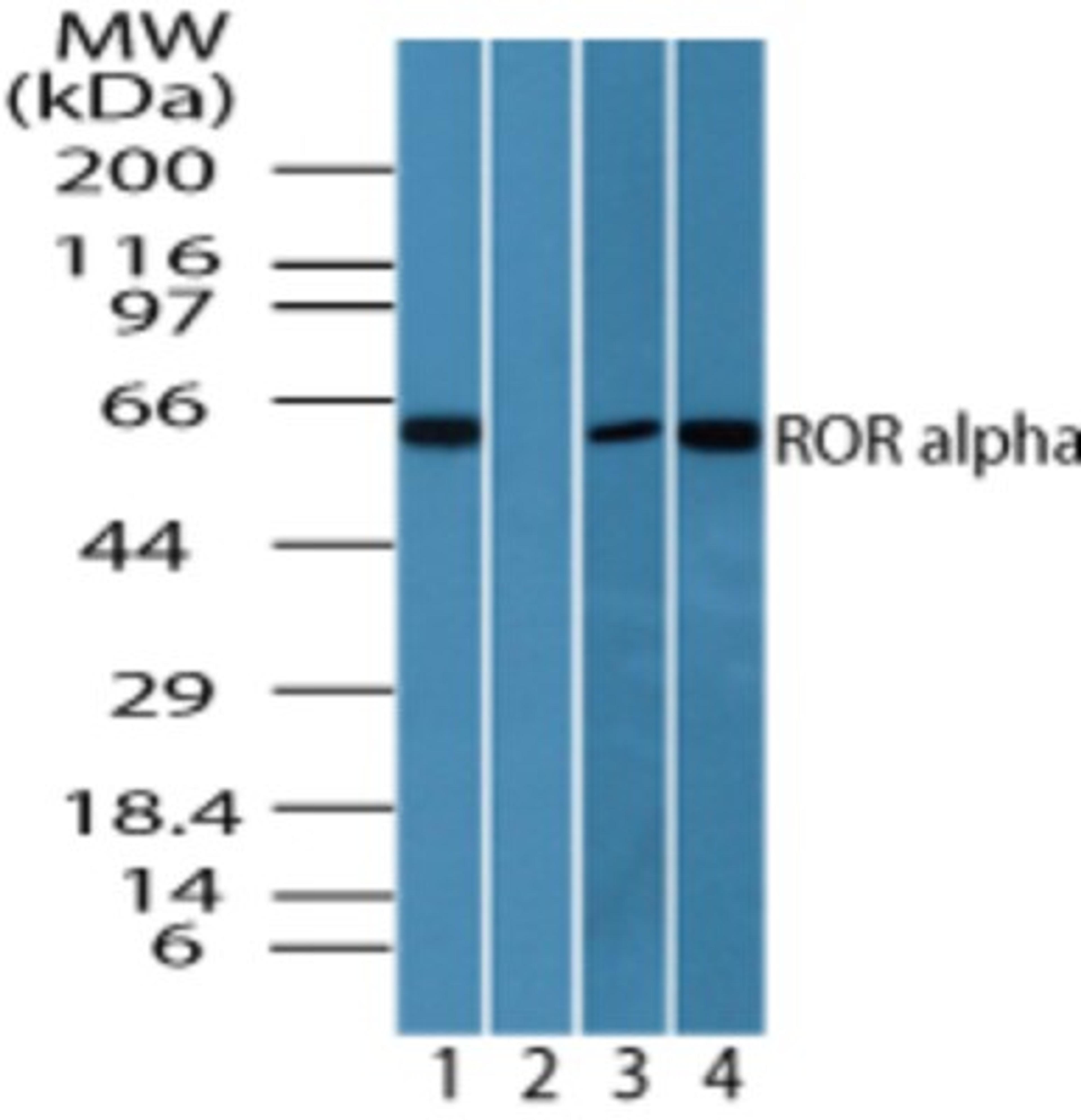 Western Blot: ROR alpha Antibody [NBP2-24519] - Analysis of ROR alpha in human skeletal muscle lysate in the 1) absence and 2) presence of immunizing peptide, 3) mouse skeletal muscle lysate and 4) rat skeletal muscle lysate using this antibody at 25 ug/ml, 0.01 ug/ml and 0.01 ug/ml, respectively.