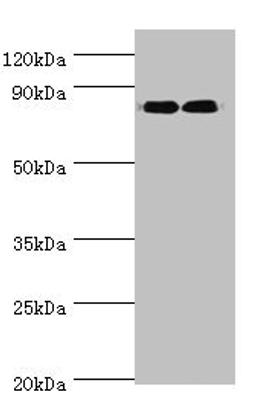 Western blot. All lanes: ANAPC5 antibody at 2ug/ml. Lane 1: 293T whole cell lysate. Lane 2: NIH/3T3 whole cell lysate. Secondary. Goat polyclonal to rabbit IgG at 1/10000 dilution. Predicted band size: 86, 26, 73 kDa. Observed band size: 86 kDa. 