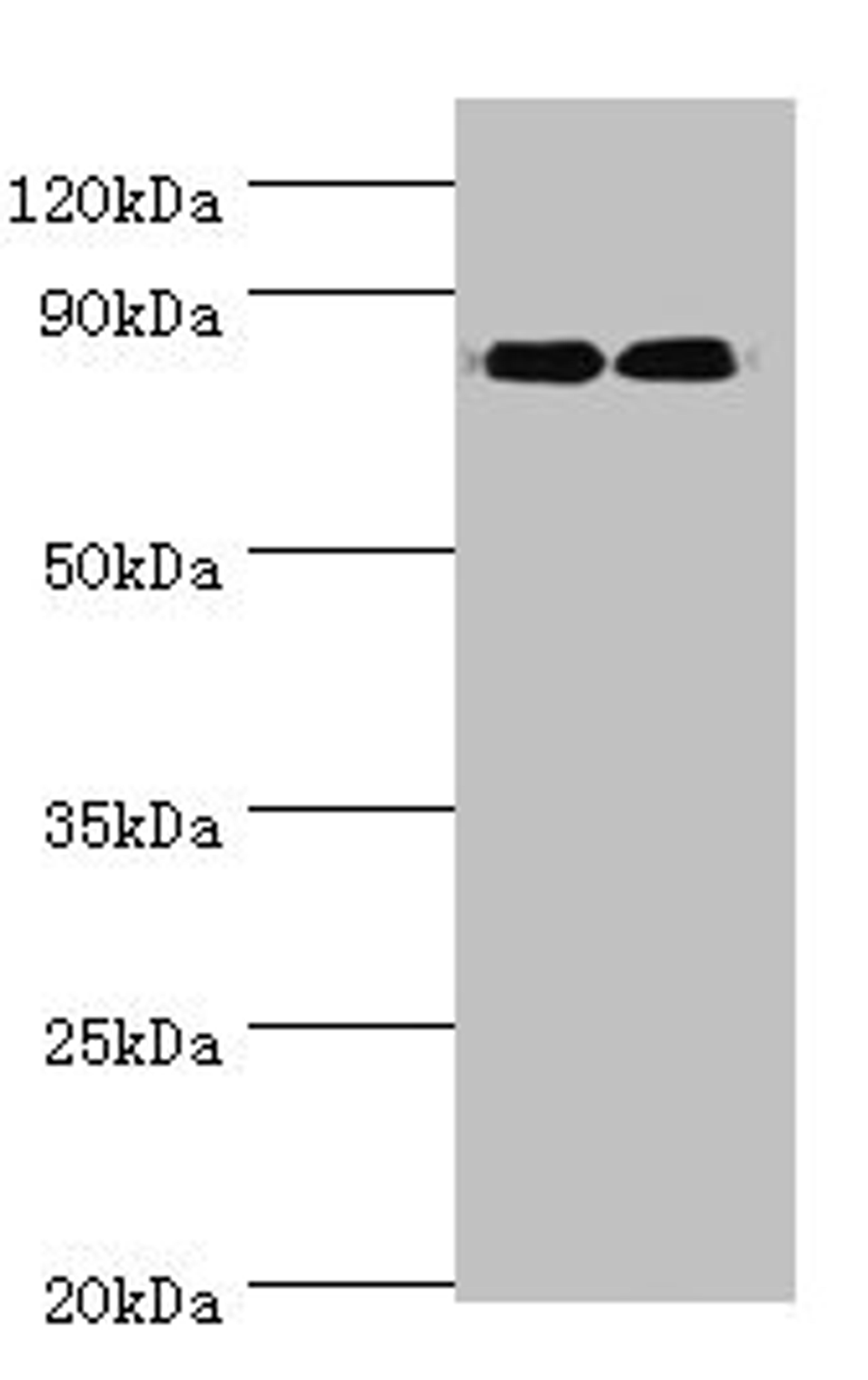 Western blot. All lanes: ANAPC5 antibody at 2ug/ml. Lane 1: 293T whole cell lysate. Lane 2: NIH/3T3 whole cell lysate. Secondary. Goat polyclonal to rabbit IgG at 1/10000 dilution. Predicted band size: 86, 26, 73 kDa. Observed band size: 86 kDa. 