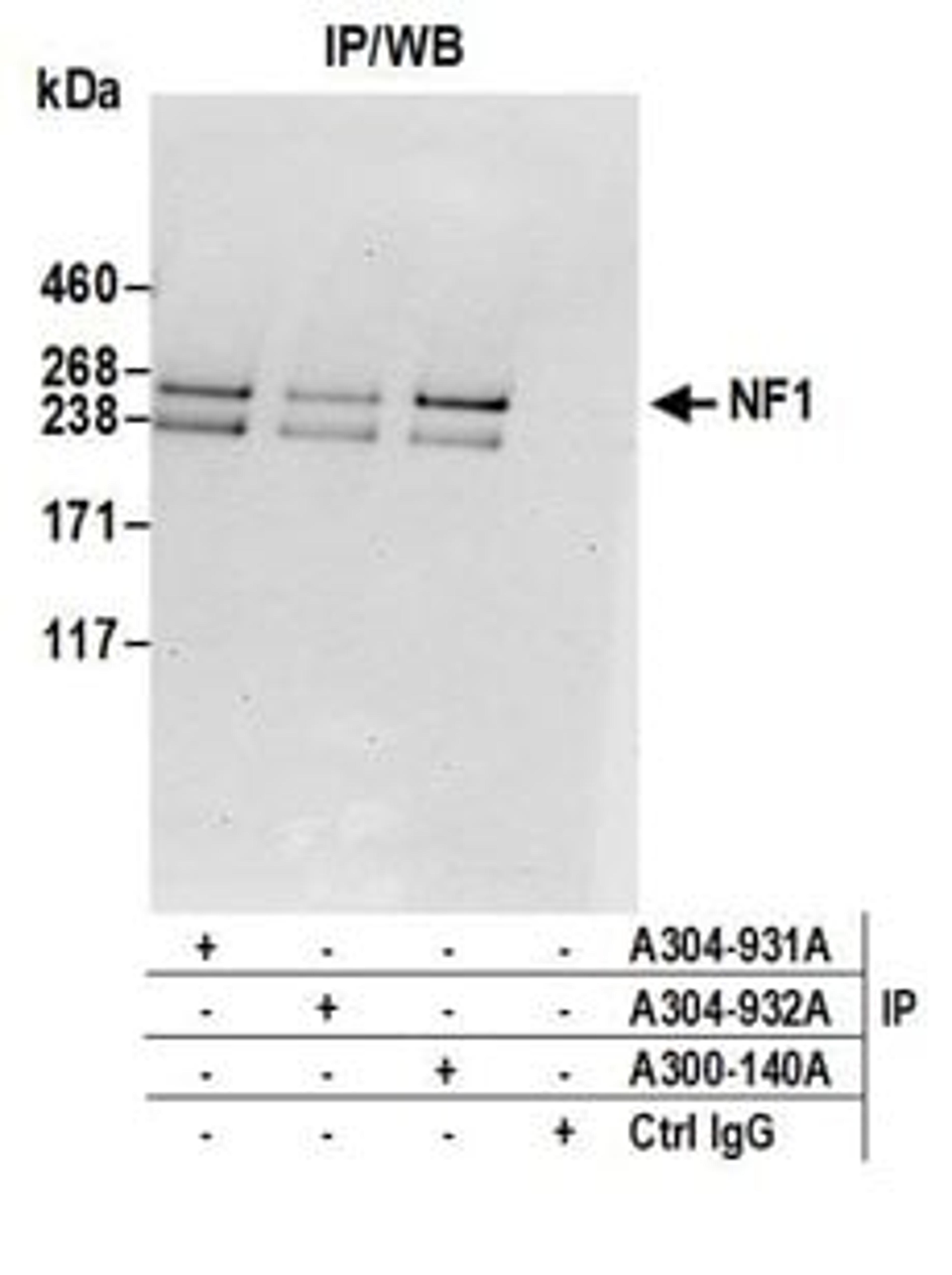 Detection of human NF1 by western blot of immunoprecipitates.