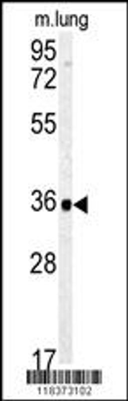 Western blot analysis of CA4 Antibody in mouse lung tissue lysates (35ug/lane)