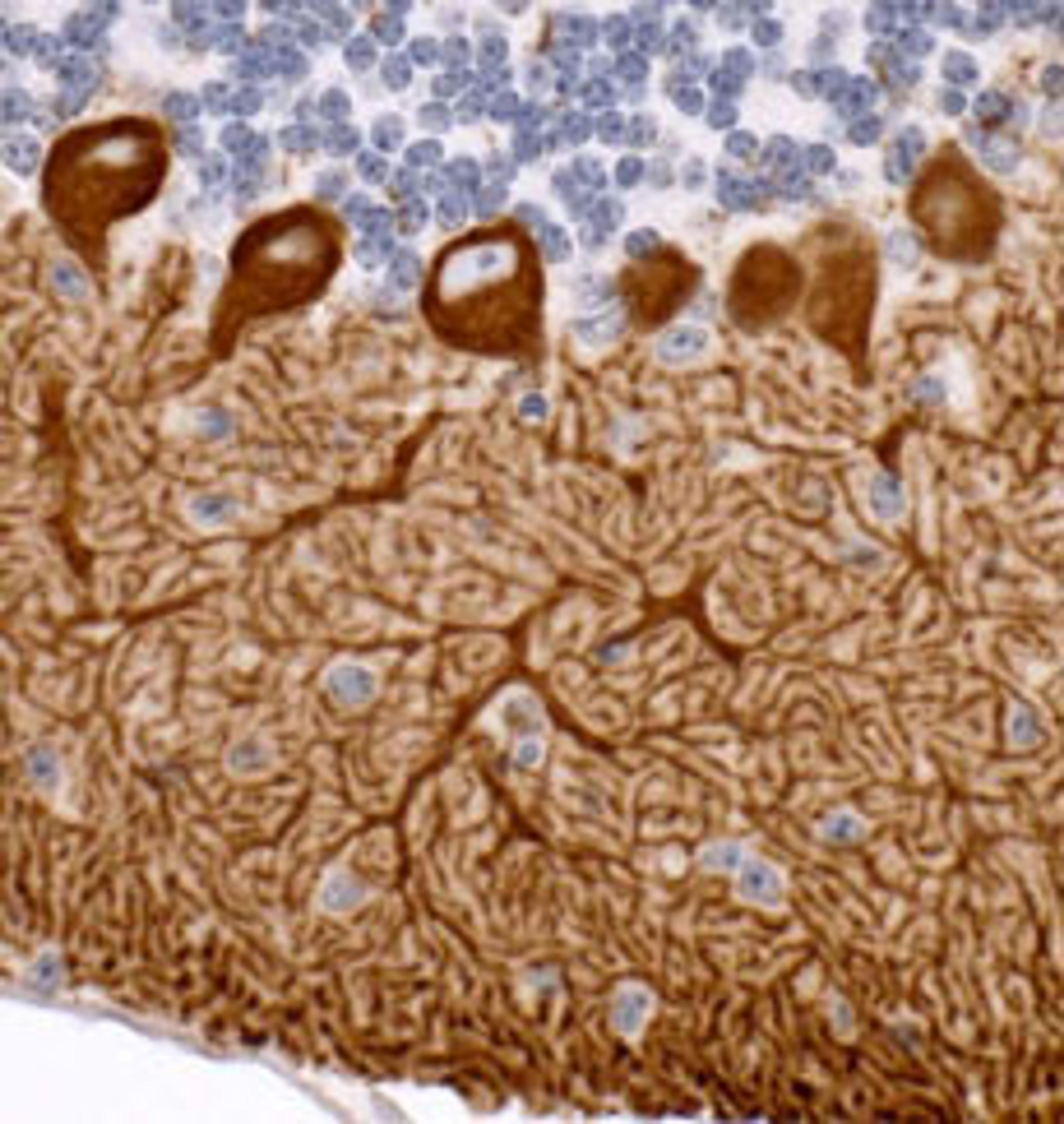 Detection of mouse IP3R1 by immunohistochemistry.