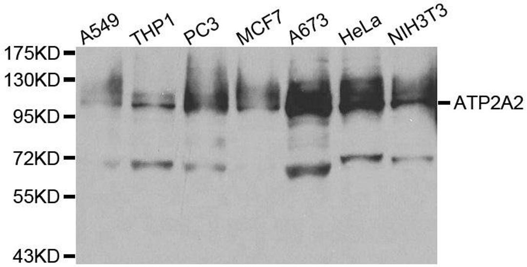 Western blot analysis of extracts of various cell lines using ATP2A2 antibody