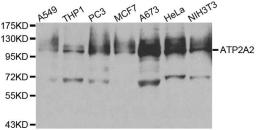 Western blot analysis of extracts of various cell lines using ATP2A2 antibody