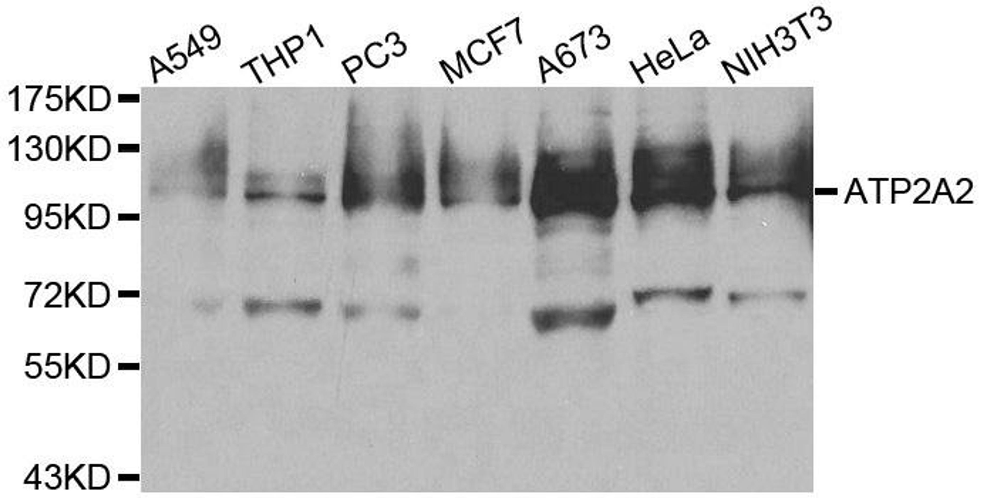 Western blot analysis of extracts of various cell lines using ATP2A2 antibody