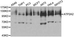 Western blot analysis of extracts of various cell lines using ATP2A2 antibody