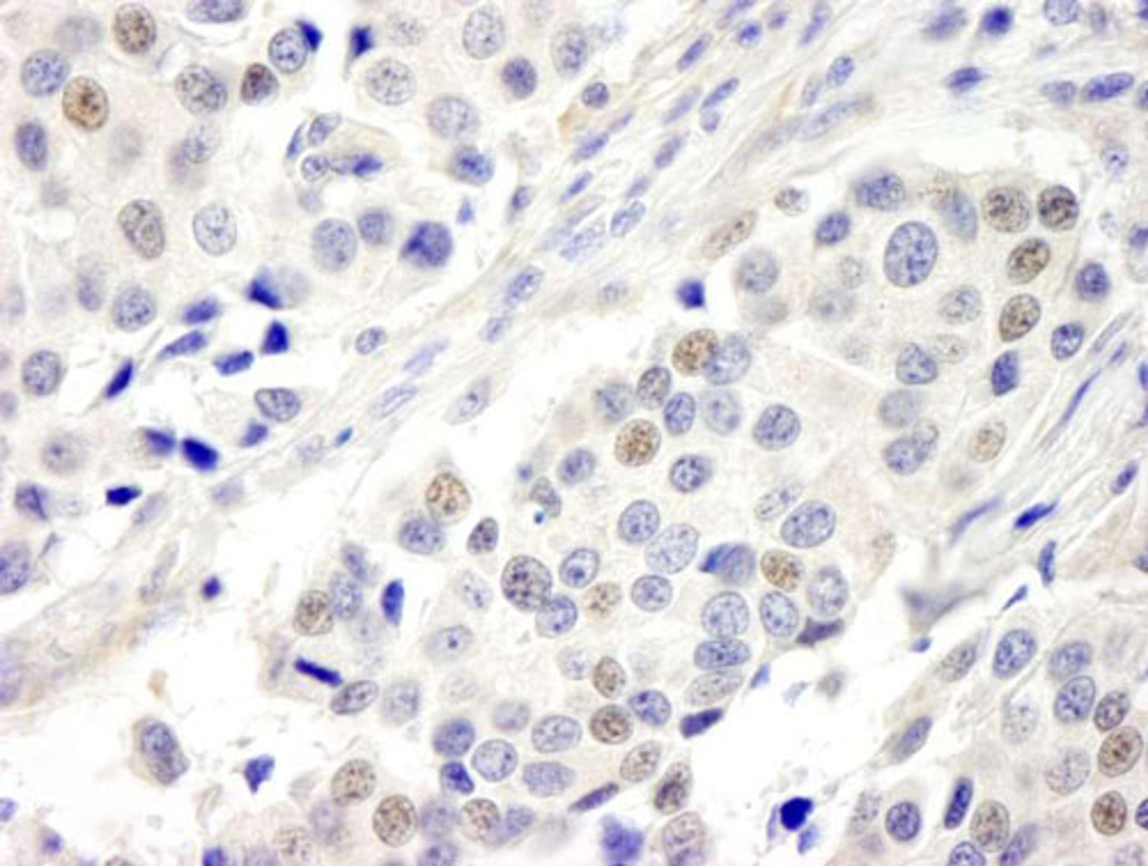 Detection of human ABC2 by IHC.