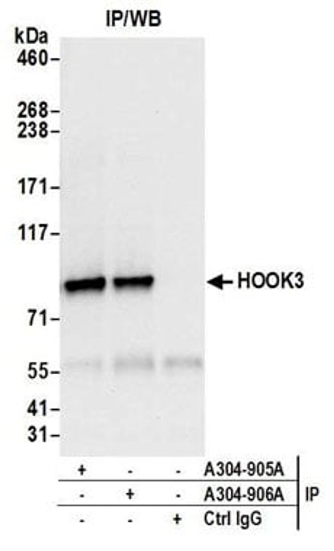 Detection of human HOOK3 by western blot of immunoprecipitates.