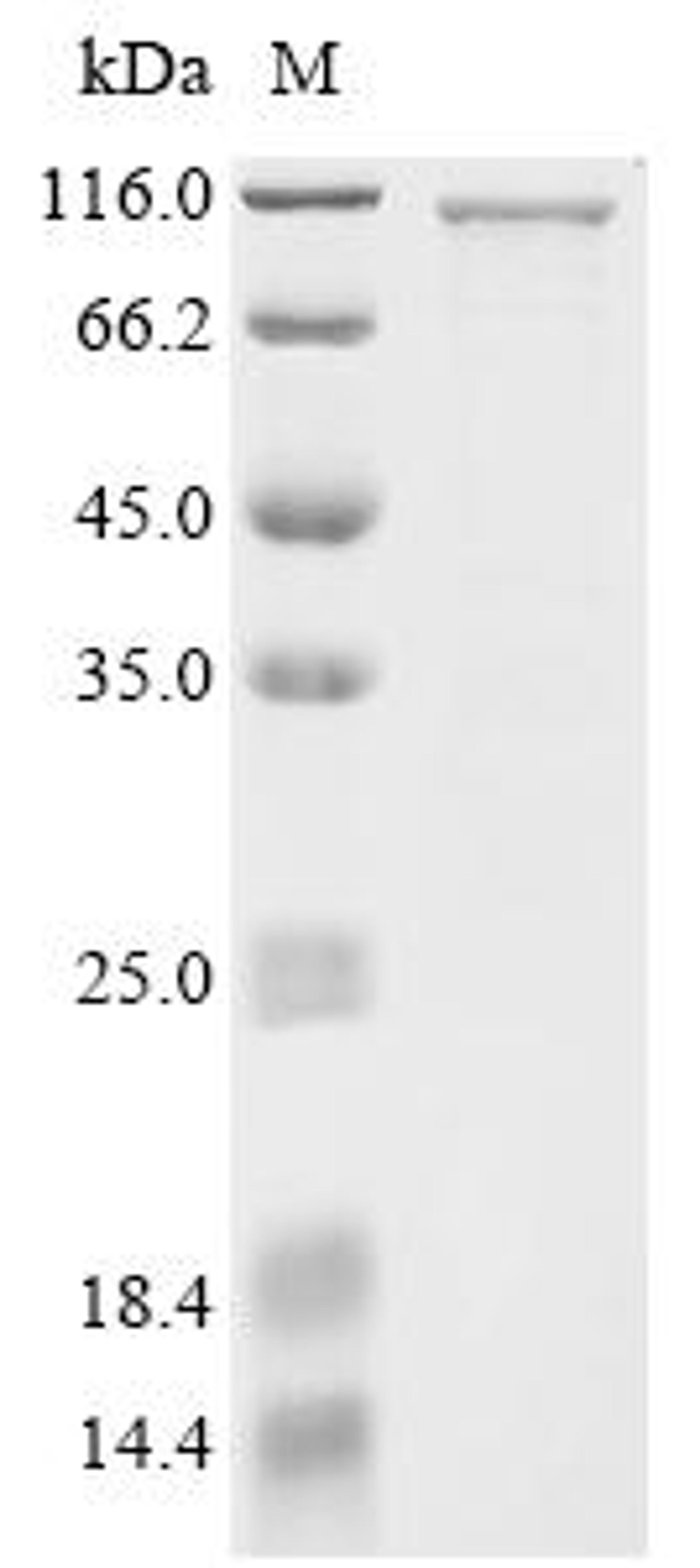 (Tris-Glycine gel) Discontinuous SDS-PAGE (reduced) with 5% enrichment gel and 15% separation gel.