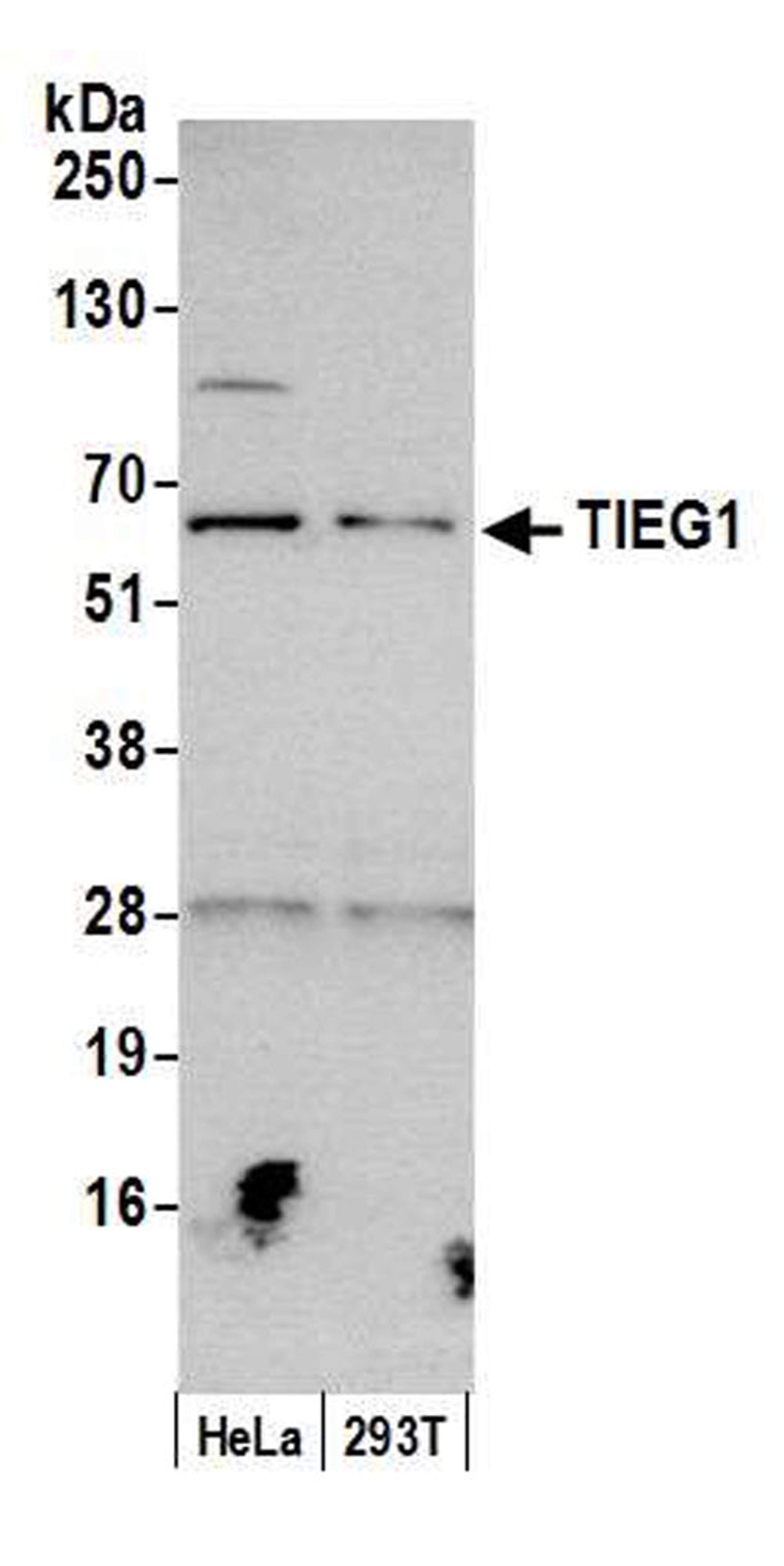 Detection of human TIEG1 by WB.