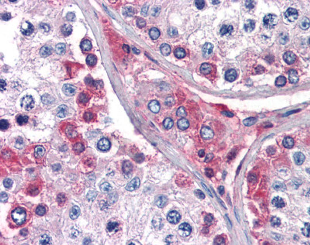 Immunohistochemistry staining of Cathepsin K in testis tissue using Cathepsin K Antibody.