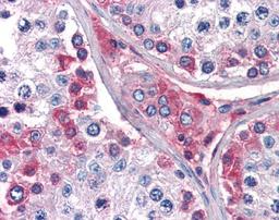 Immunohistochemistry staining of Cathepsin K in testis tissue using Cathepsin K Antibody.