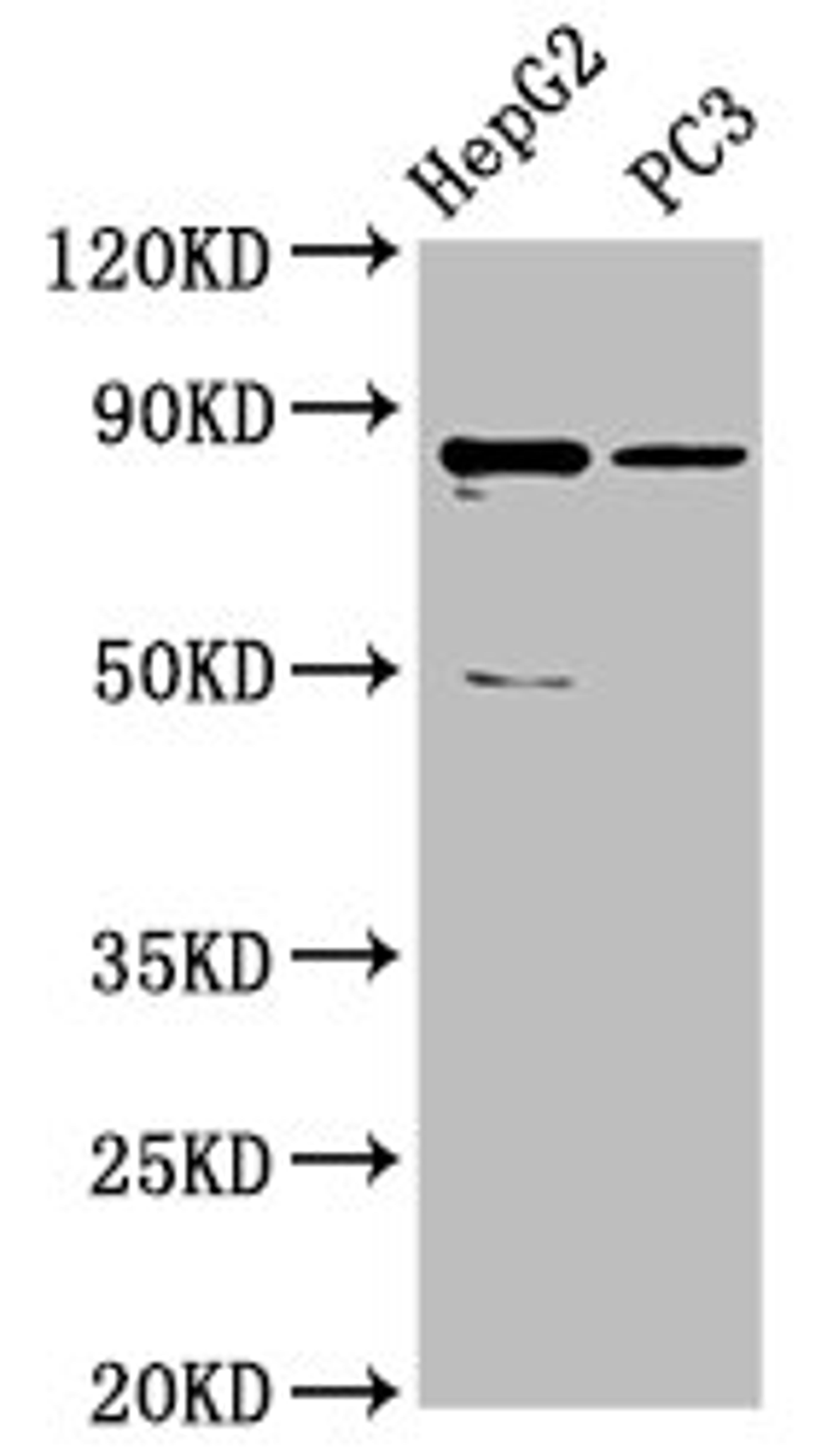 Western Blot. Positive WB detected in: HepG2 whole cell lysate, PC-3 whole cell lysate. All lanes: CCDC170 antibody at 5µg/ml. Secondary. Goat polyclonal to rabbit IgG at 1/50000 dilution. Predicted band size: 83 kDa. Observed band size: 83 kDa