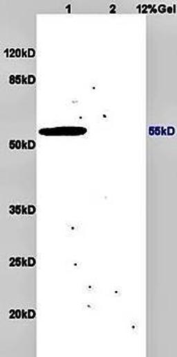 Western blot analysis of mouse brain lysates (Lane1), mouse heart lysates (Lane2) dilution at:1:200 using Measles virus antibody