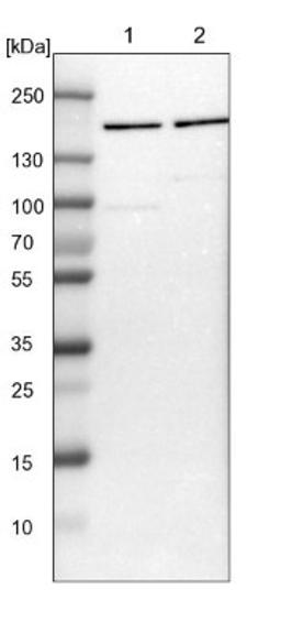 Western Blot: ROCK2 Antibody [NBP1-86124] - Lane 1: NIH-3T3 cell lysate (Mouse embryonic fibroblast cells)<br/>Lane 2: NBT-II cell lysate (Rat Wistar bladder tumour cells)