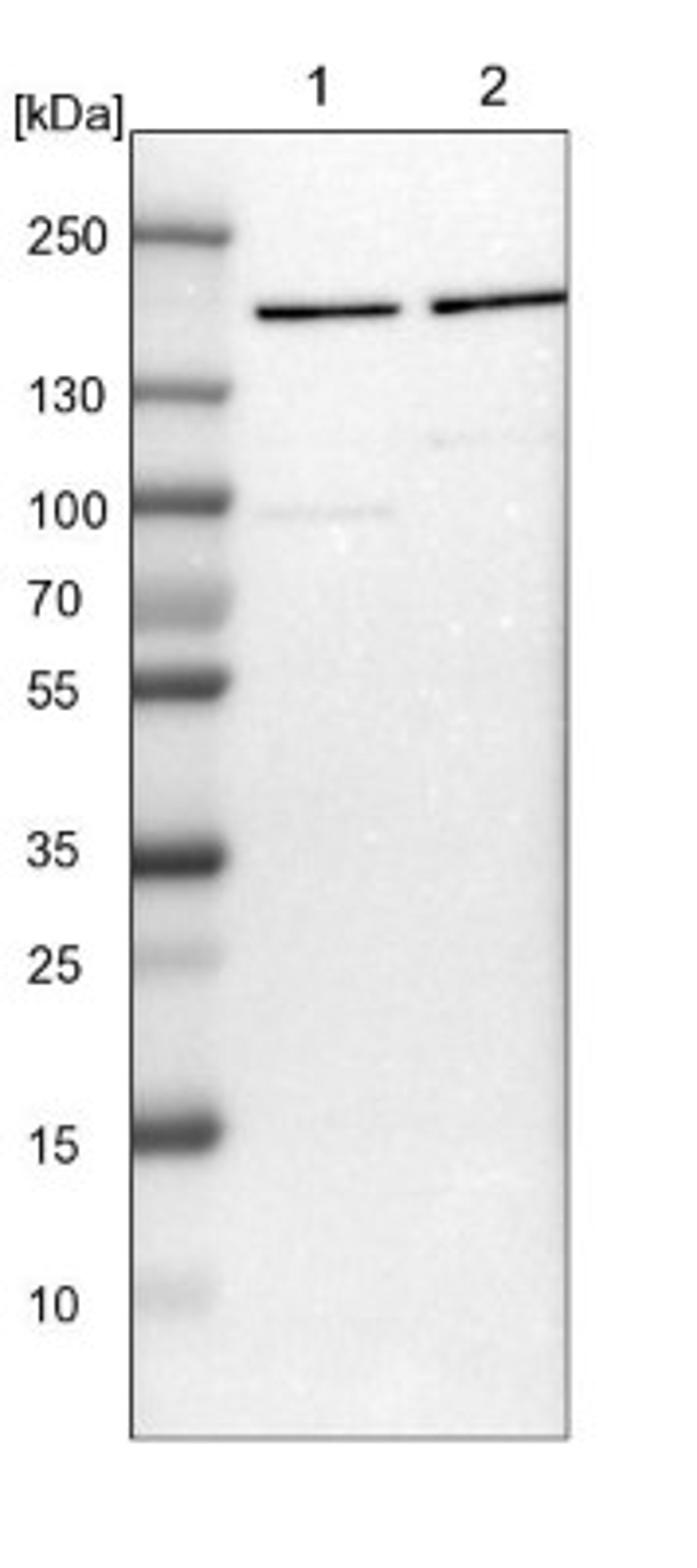 Western Blot: ROCK2 Antibody [NBP1-86124] - Lane 1: NIH-3T3 cell lysate (Mouse embryonic fibroblast cells)<br/>Lane 2: NBT-II cell lysate (Rat Wistar bladder tumour cells)