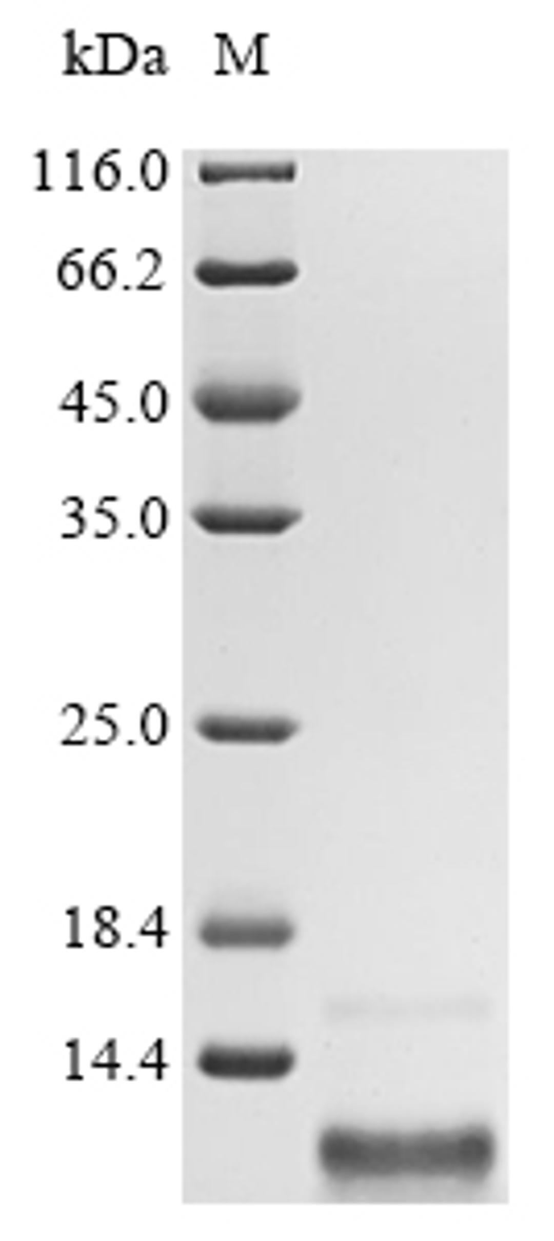 (Tris-Glycine gel) Discontinuous SDS-PAGE (reduced) with 5% enrichment gel and 15% separation gel.