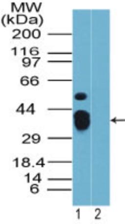 Western Blot: Rhox9 Antibody [NBP2-23844] - analysis of Rhox-9 in mouse placenta in the 1) absence and 2) presence of immunizing peptide using this antibody. I goat anti-rabbit Ig HRP secondary antibody and PicoTect ECL substrate solution were used for this test.