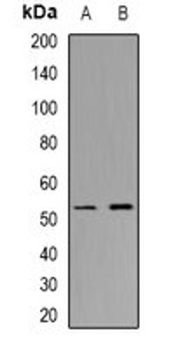 Western blot analysis of A549 (Lane1), HepG2 (Lane2) whole cell lysates using CHST9 antibody