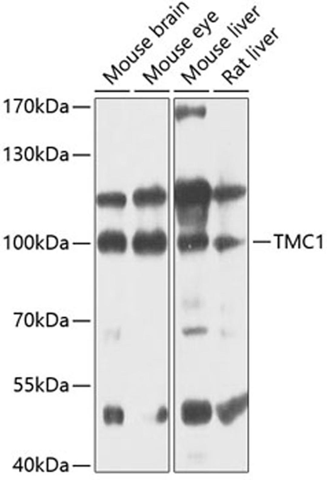 Western blot - TMC1 antibody (A12609)