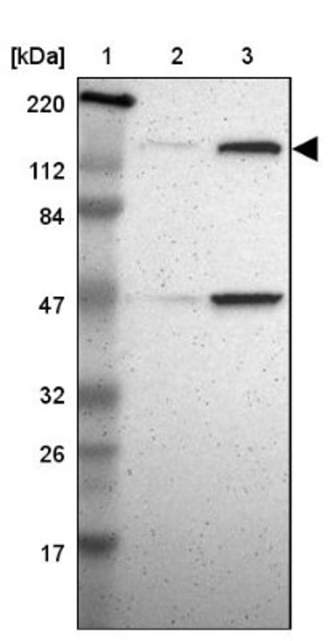 Western Blot: TTF2 Antibody [NBP1-83148] - Lane 1: Marker [kDa] 220, 112, 84, 47, 32, 26, 17<br/>Lane 2: Human cell line RT-4<br/>Lane 3: Human cell line U-251MG