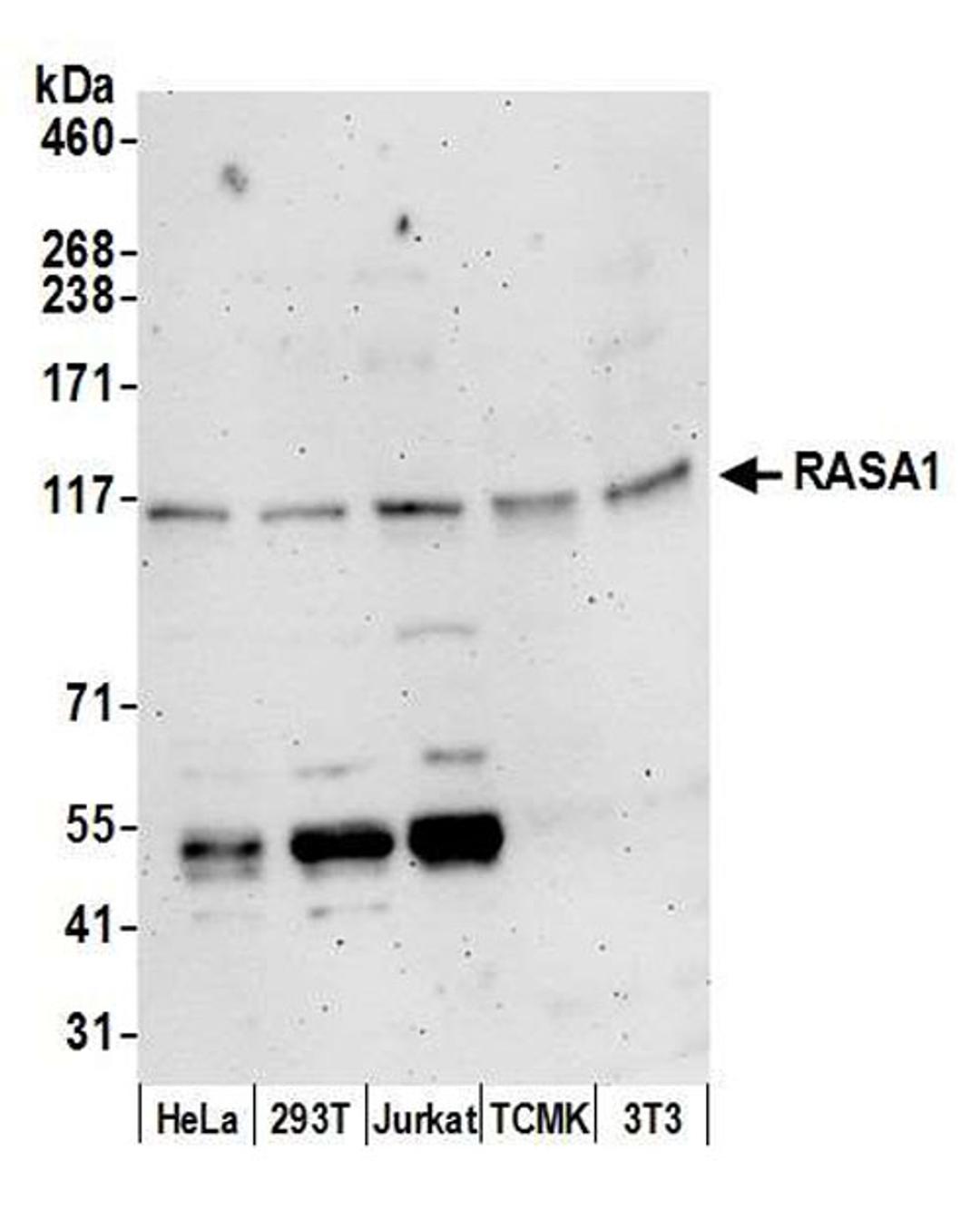 Detection of human and mouse RASA1 by WB.