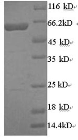 (Tris-Glycine gel) Discontinuous SDS-PAGE (reduced) with 5% enrichment gel and 15% separation gel.