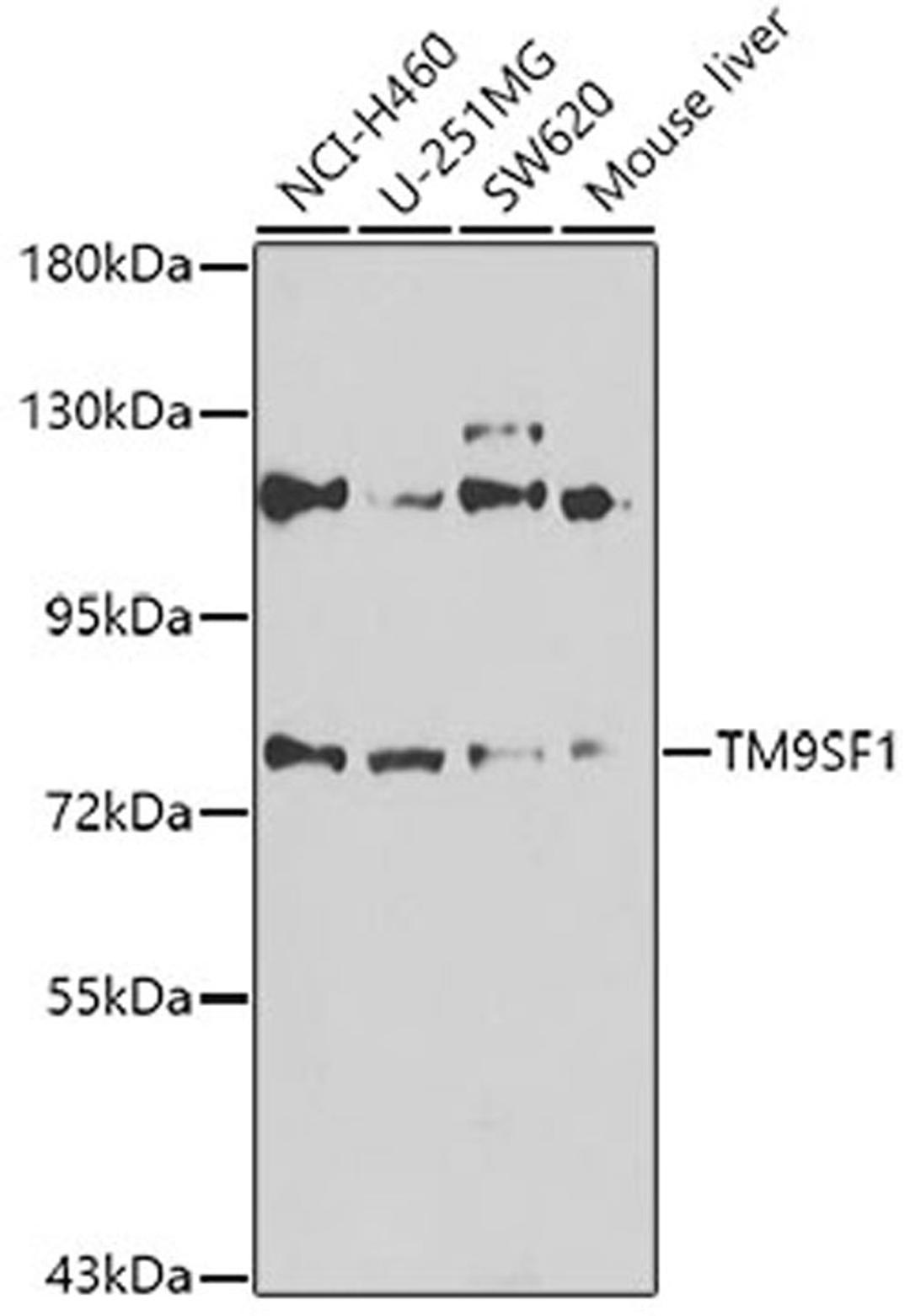 Western blot - TM9SF1 antibody (A7461)