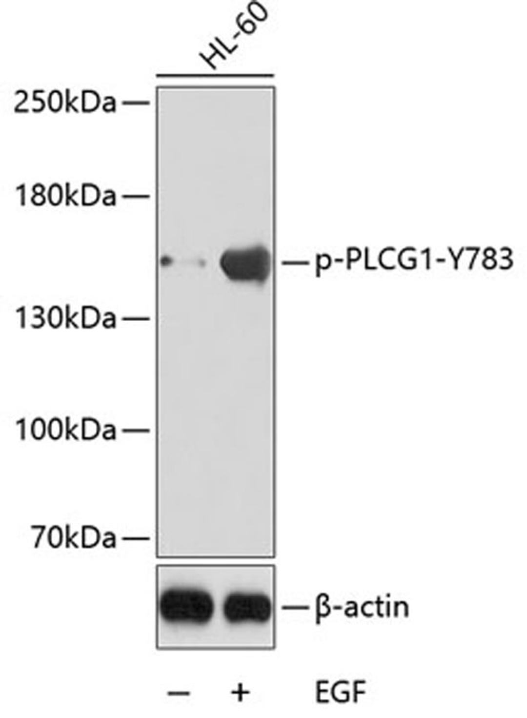 Western blot - phospho-PLCG1-Y783 antibody (AP0164)