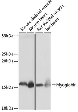 Western blot - Myoglobin Rabbit mAb (A11368)