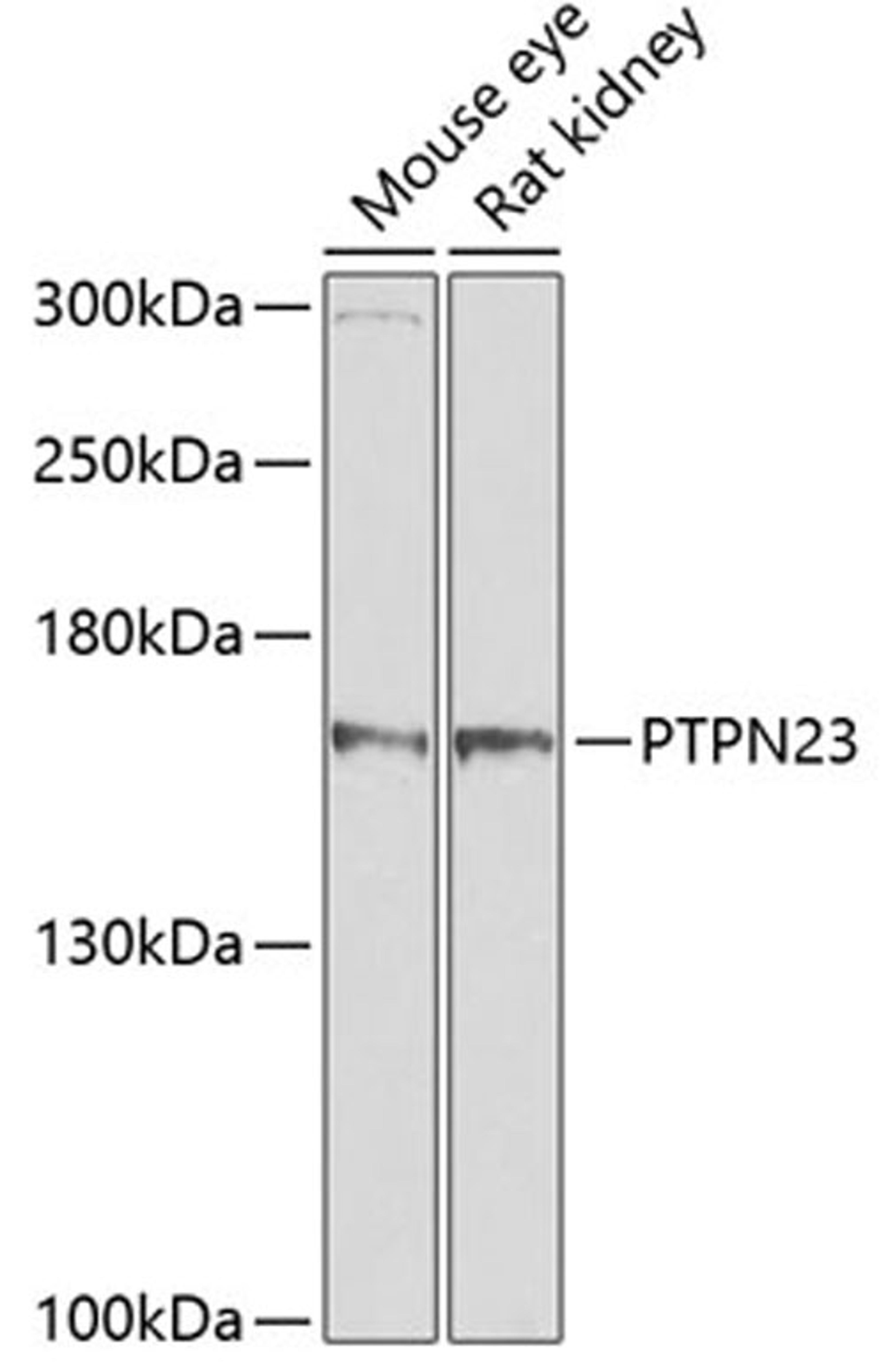 Western blot - PTPN23 antibody (A4595)