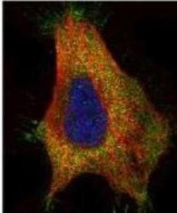 Immunocytochemistry/Immunofluorescence: GAD65 Antibody [NBP1-33284] - Paraformaldehyde-fixed HeLa, using GAD65 antibody (Green) at 1:500 dilution. Alpha-tubulin filaments were labeled with Red at 1:2500.