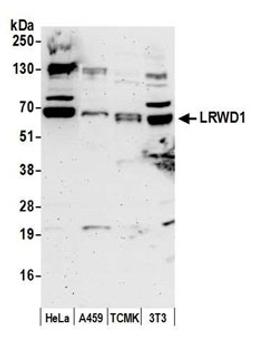 Detection of human and mouse LRWD1 by western blot.