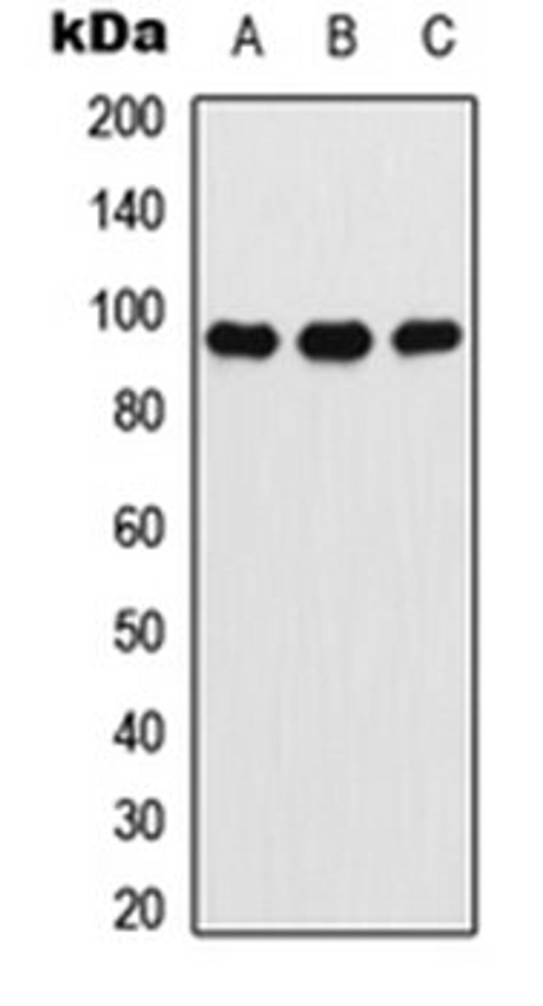 Western blot analysis of A549 (Lane 1), NIH3T3 (Lane 2), PC12 (Lane 3) whole cell lysates using Ataxin 7 antibody