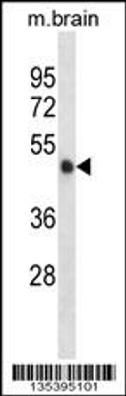 Western blot analysis in mouse brain tissue lysates (35ug/lane).