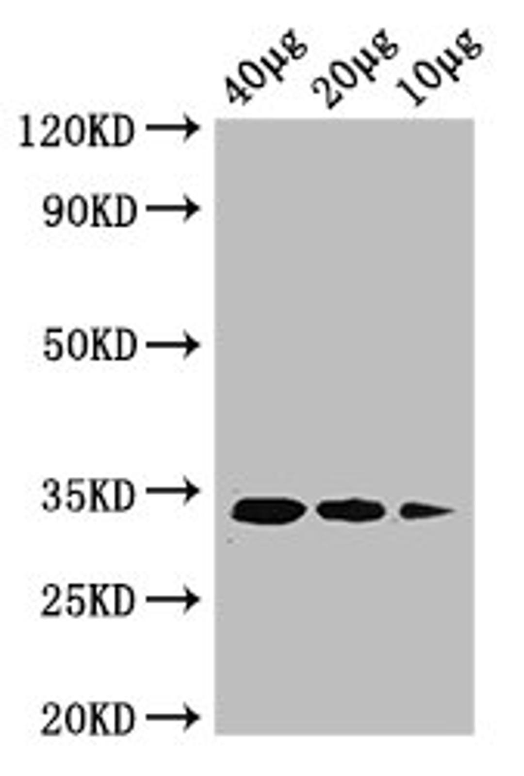 Western Blot. Positive WB detected in: Rosseta bacteria lysate at 40ug, 20ug, 10ug. All lanes: ldcA antibody at 1ug/ml. Secondary. Goat polyclonal to rabbit IgG at 1/50000 dilution. predicted band size: 34 kDa. observed band size: 34 kDa. 