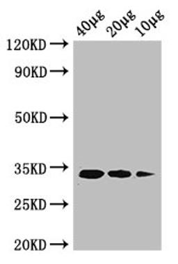 Western Blot. Positive WB detected in: Rosseta bacteria lysate at 40ug, 20ug, 10ug. All lanes: ldcA antibody at 1ug/ml. Secondary. Goat polyclonal to rabbit IgG at 1/50000 dilution. predicted band size: 34 kDa. observed band size: 34 kDa. 
