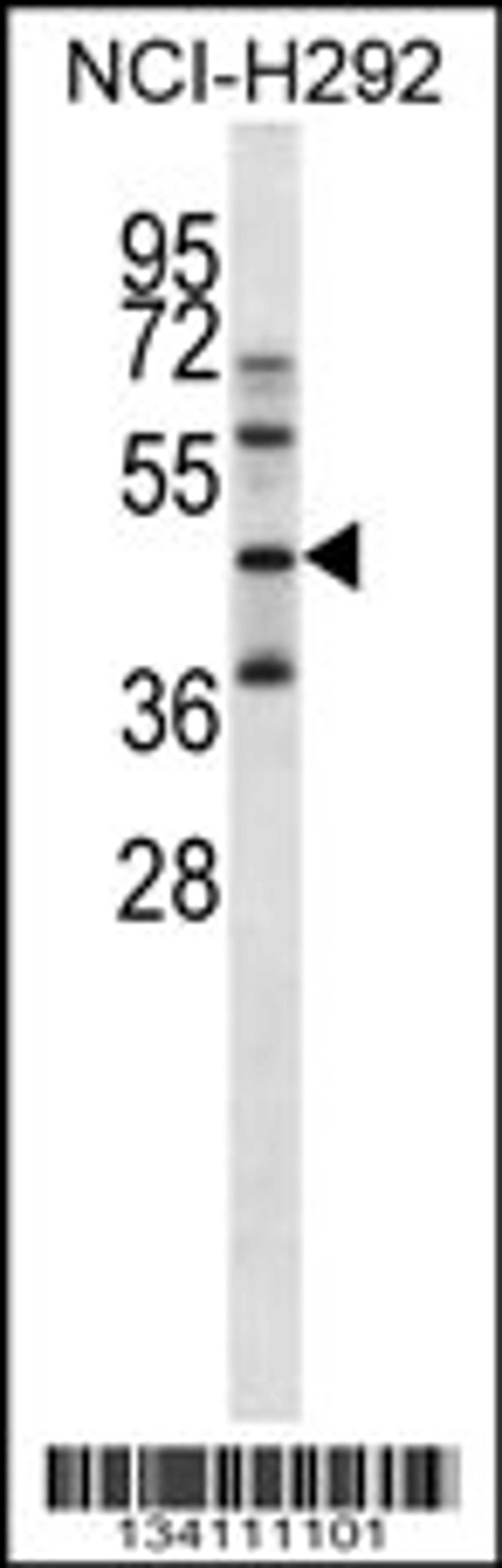 Western blot analysis in NCI-H292 cell line lysates (35ug/lane).