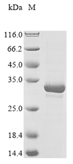 (Tris-Glycine gel) Discontinuous SDS-PAGE (reduced) with 5% enrichment gel and 15% separation gel.